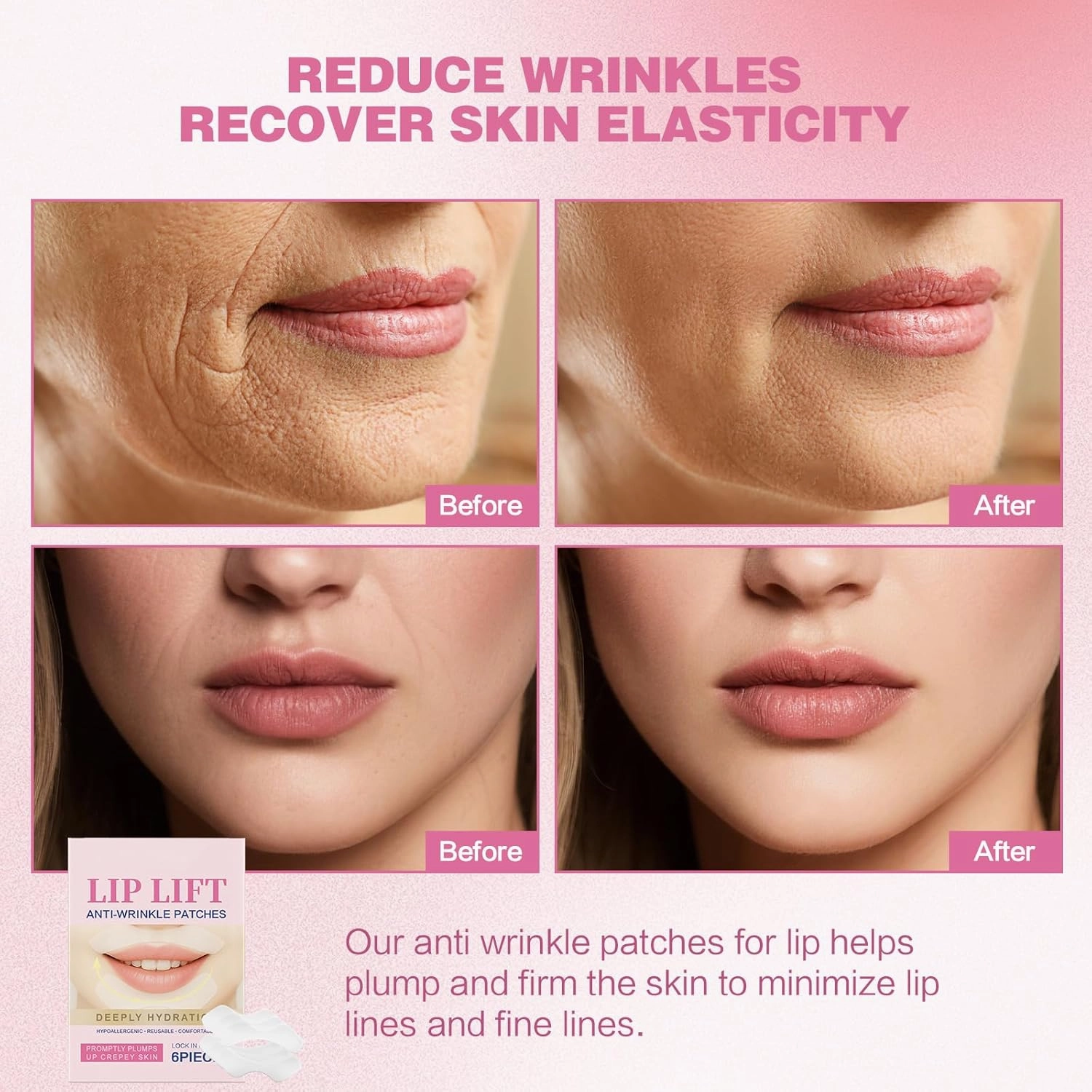 12PC Anti Wrinkle Patches for Lip, Smile Line Patches, Overnight Smoothing Anti-Wrinkle Face Patches for Smile Line & Lip Area, Wrinkles & Moisturising
