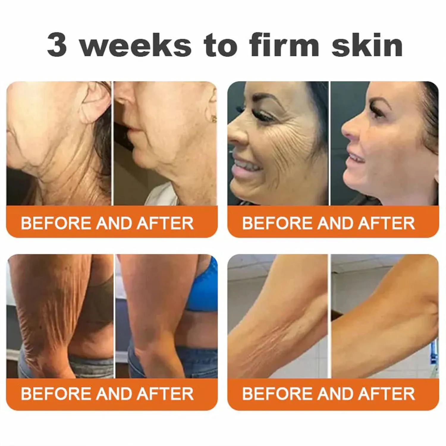 Botox Bee Venom Firming Serum Stick, Advanced Firming & Wrinkle-Reducing Cream, Bee Venom Wrinkle Remover Cream, Bee Venom Firming Serum Stick, Hydrates & Nourishes Skin (1PC)