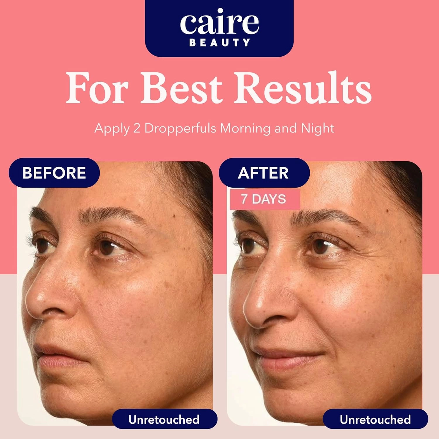 Caire ‘Own Your Age’ Bioavailable Hyaluronic Acid Collagen Peptide Serum for Face, Eyes   Neck | 15ml