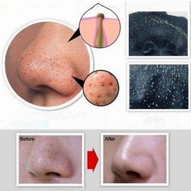 Deep cleansing face mask