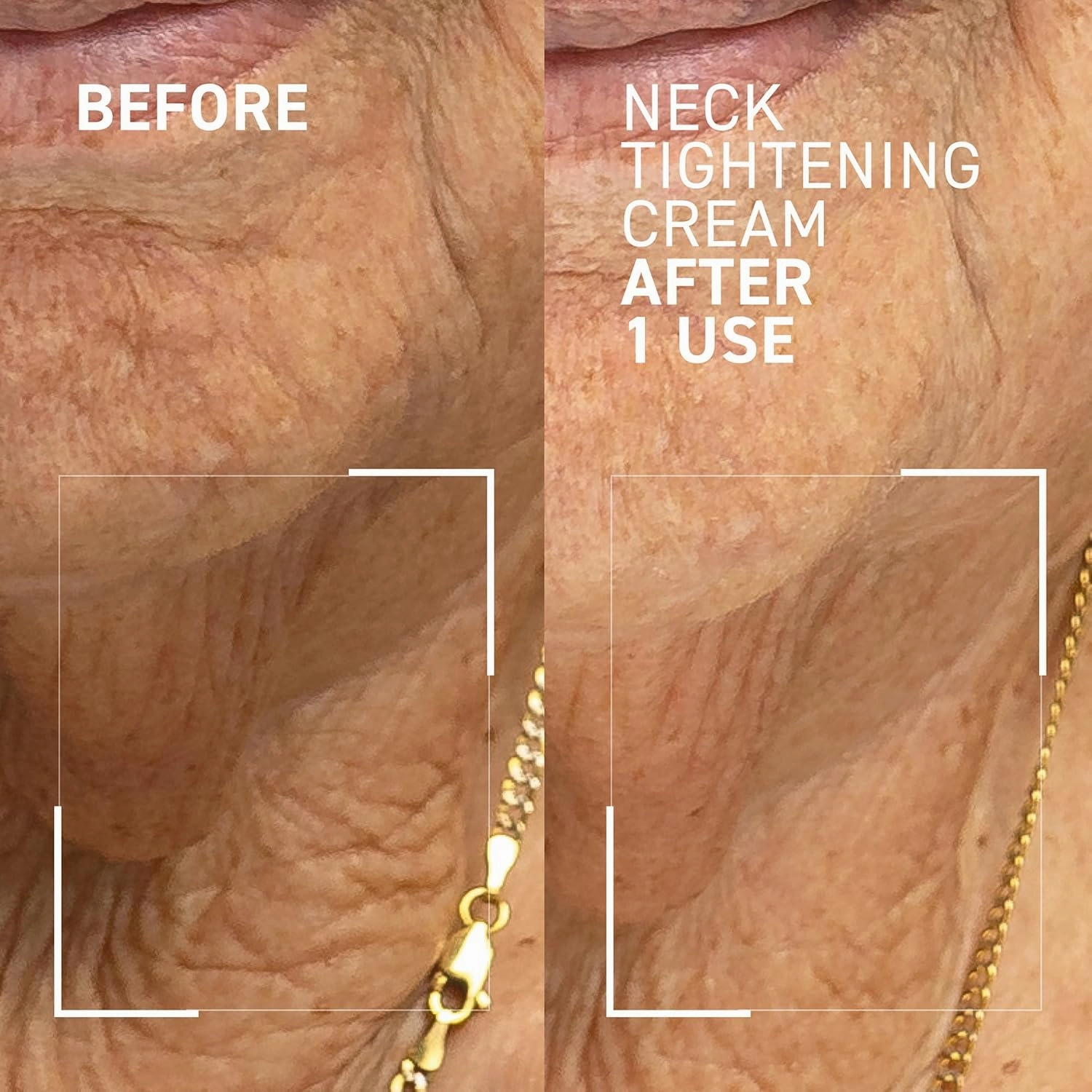 Dr. Brandt Needles No More Neck Tightening Cream - Lifts, Tightens & Reduces Skin Sagginess - Includes a Rose Quartz Gua Sha Tool - 1.7 oz, Pack of 2