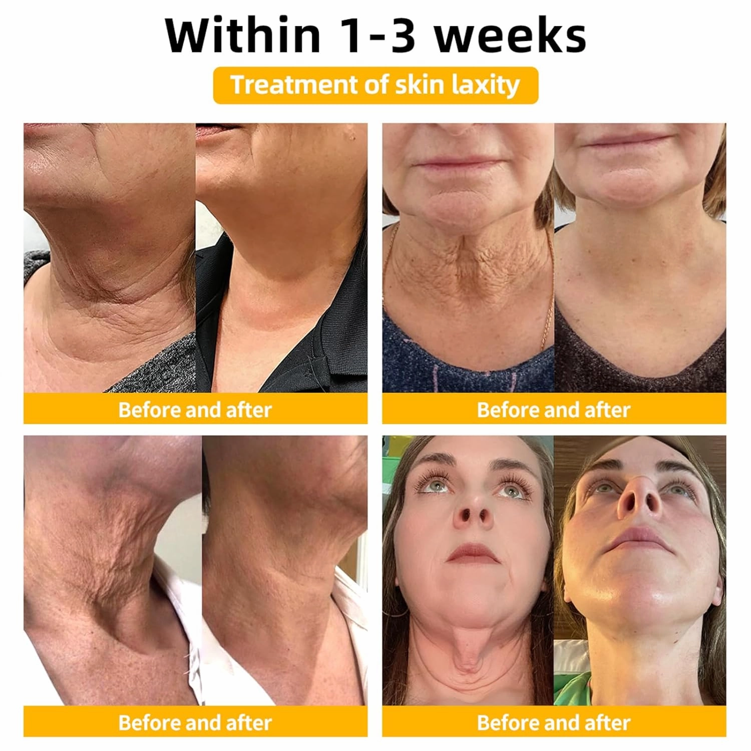 Fivfivgo Ultra Firming & Revitalizing Cream，Advanced New Fivfivgo Skin Firming Cream, Body Lotion Moisturizer, Face Lotion & Body Cream-Renew Skin Firmness for All Skin Types (3Bottles, 60ml)