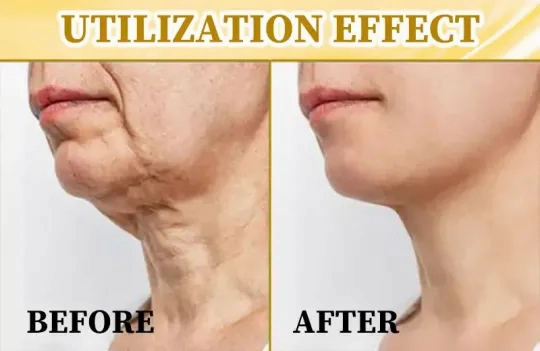 Fivfivgo™ Ultra-straffende & reparierende Mehrzweckcreme: Haut neu formen, Zellen aktivieren