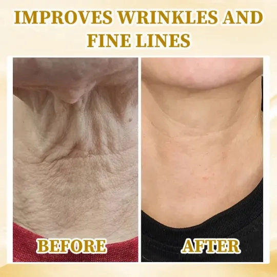 Fivfivgo™ Ultra-straffende & reparierende Mehrzweckcreme: Haut neu formen, Zellen aktivieren