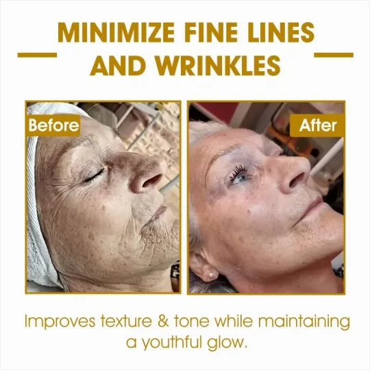 Fivfivgo™ Ultra-straffende & reparierende Mehrzweckcreme: Haut neu formen, Zellen aktivieren