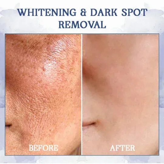 Fivfivgo™ Ultra-straffende & reparierende Mehrzweckcreme: Haut neu formen, Zellen aktivieren