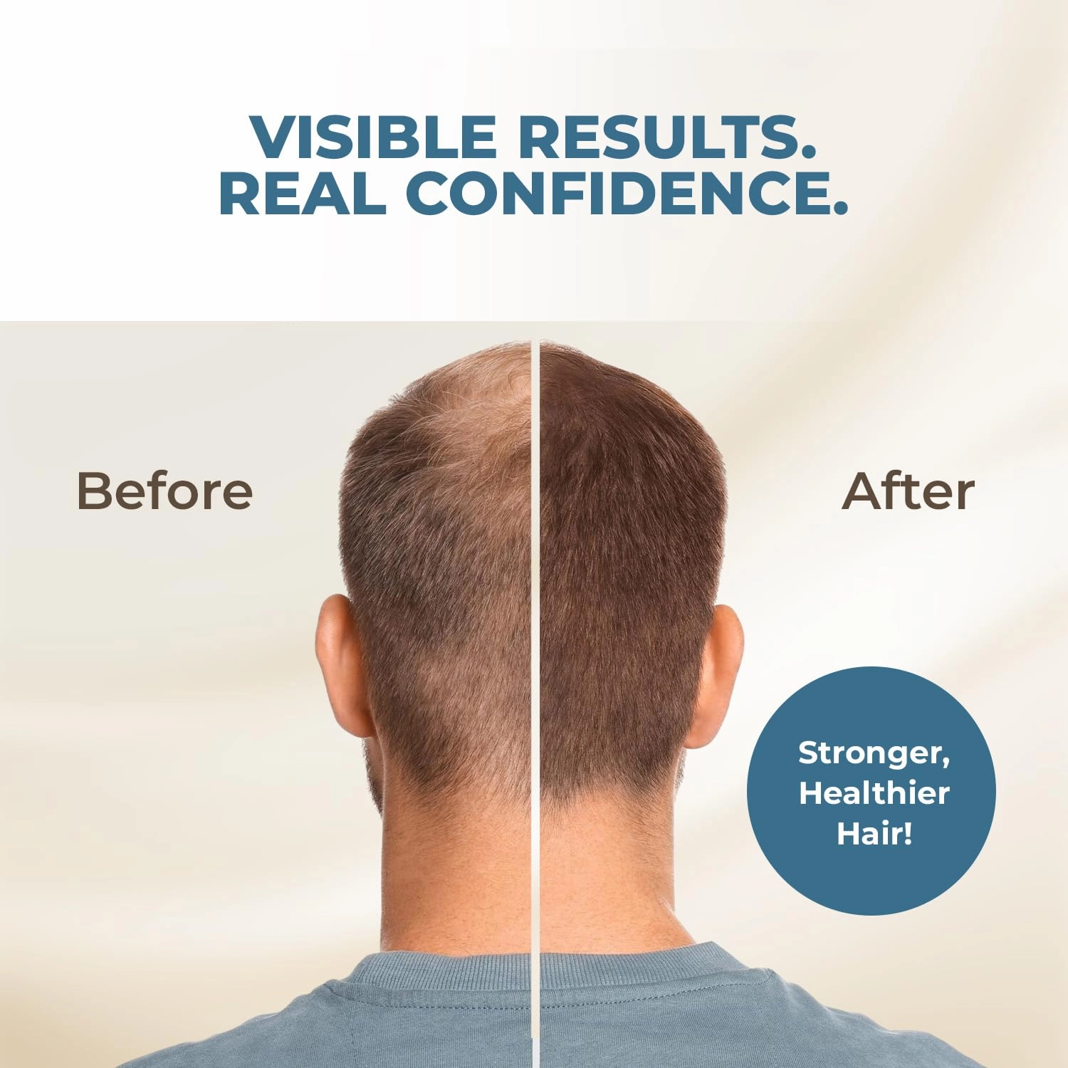 HAIRMETTO® Topical Saw Palmetto and Pumpkin Seed Oil Extract for Hair Loss, Strengthens Hair Roots, Soothes Dry Scalp, with Rosemary, Castor Oil, and Lavender Scent, 4oz Bottle