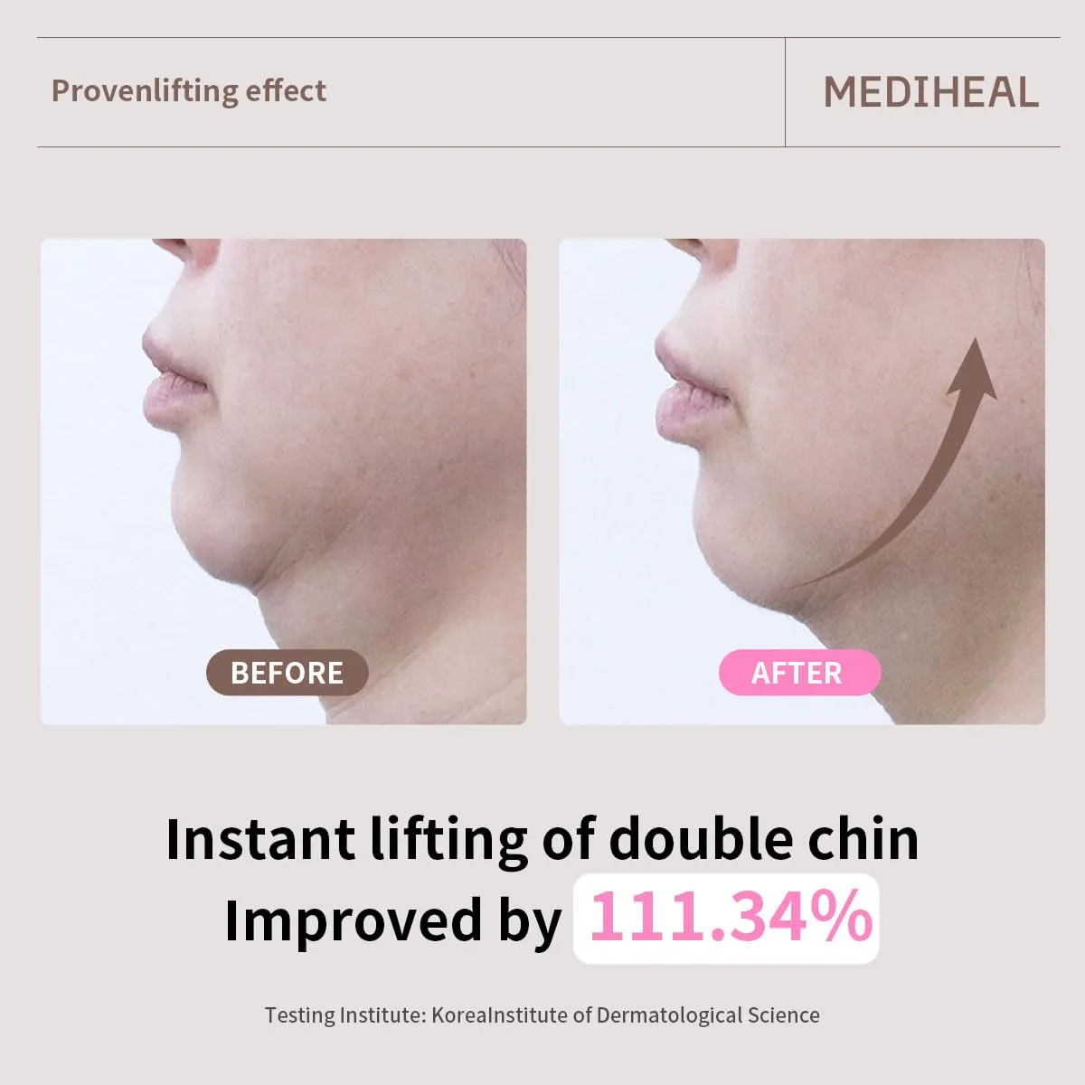 Mediheal Retinol Collagen Ampoule Lifting Mask (4 Counts) for V Line Mask Anti-Aging - Helps Reduce Fine Lines & Wrinkles, and Smoothens Skin