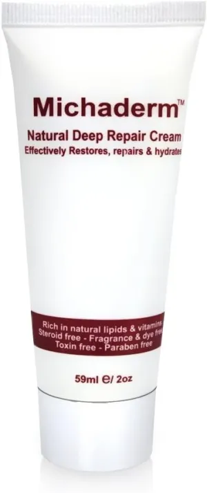 Natural Psoriasis Soothing Cream from Michaderm for Cracked Skin, Flaky Patches, Painful cuts or Cracks, Minor Skin Injuries, Steroid Free, 2oz