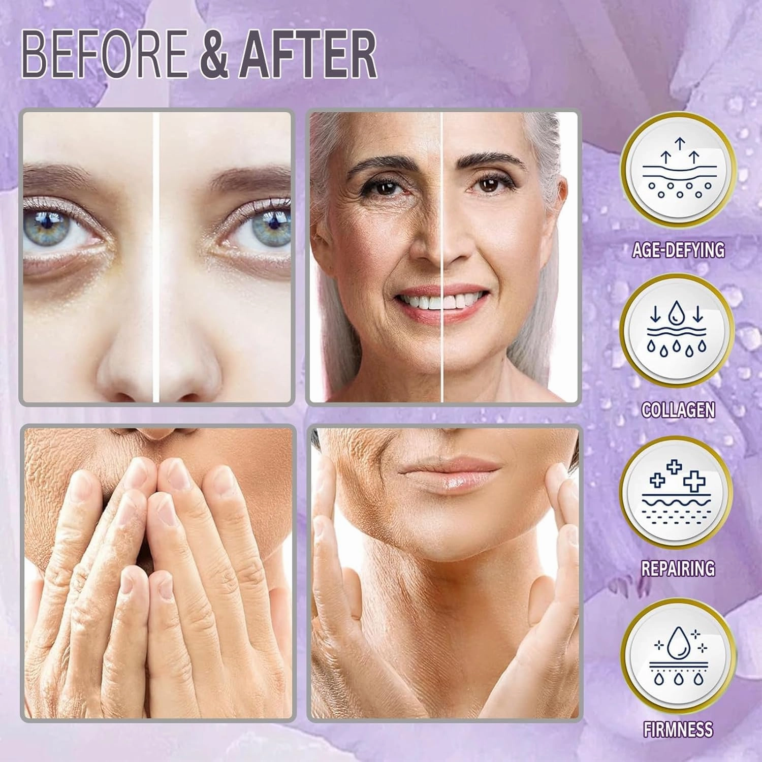 Pdo Threads for Face Lift Pdo Mono Thread Collagen Threads for Wrinkles hilos tensores para el rostro invisibles (pdo-30G25mm-20pcs)