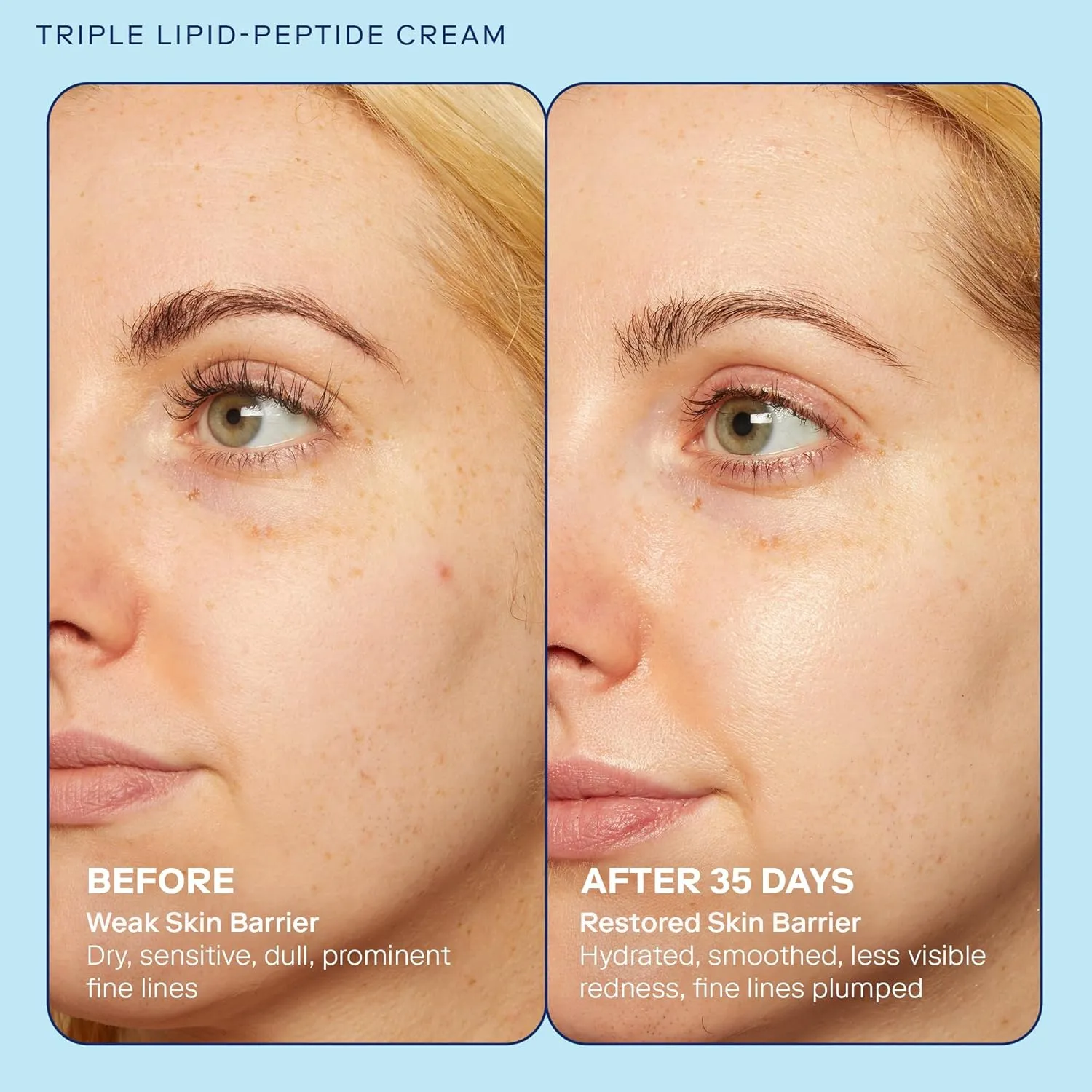 Skinfix Barrier  Triple Lipid-Peptide Cream: Enriched with Lipids, Peptides, Hyaluronic Acid, and Shea Butter for Brightening, Firming, and Plumping, 1.7 oz