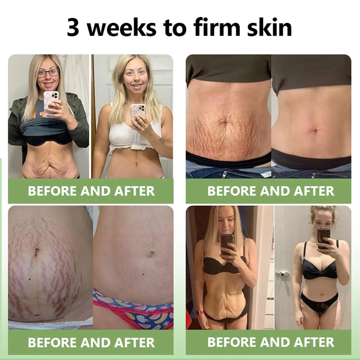 STDEI Luxurious Collagen Firming Cream, Luxurious Collagen Cream, STDEI Collagen Firming Lotion Body Moisturizer Lifts, Firms, & Tightens For Younger Looking Skin, For All Skin Types (2 Bottle)