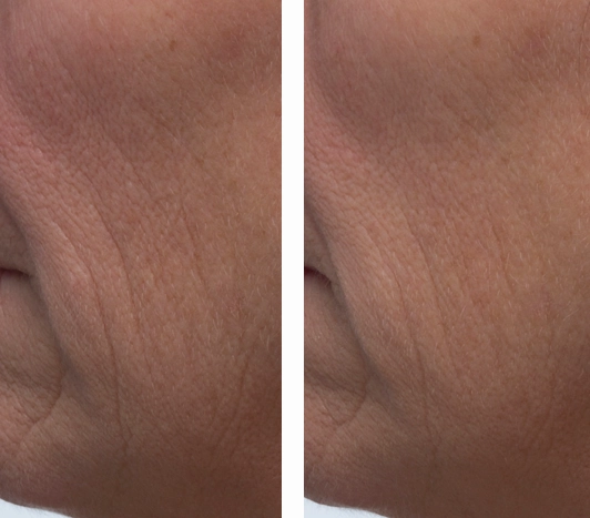 Triple Strength Peptide Super Drops