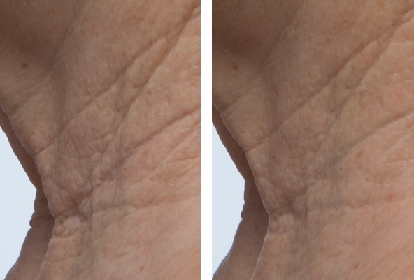 Triple Strength Peptide Super Drops