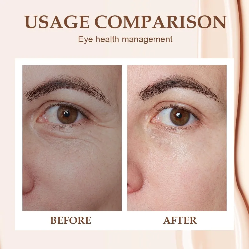 Under Eye Balm Stick with Retinol & Vitamin C, Dark Circles & Puffiness Treatment for Women, Hydrating Eye Cream for Wrinkles, Eyes Bags, and Fine Lines – Revive & Glow Eyes Balm for Brightening (2)