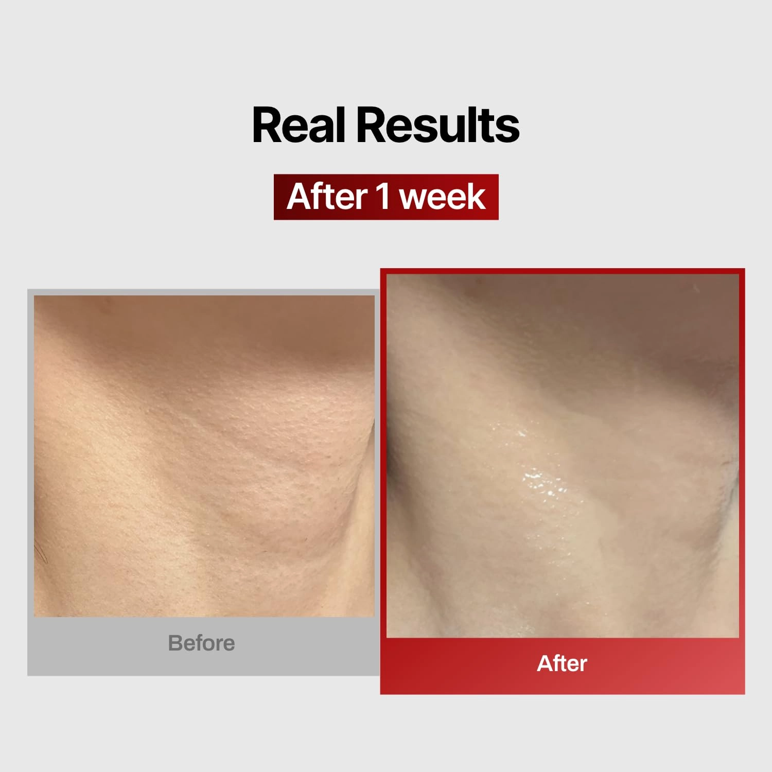 Wrinkle-fit Neck Mask - Neck Wrinkle Patches, Firming and Tightening Korean Deep Collagen Mask - Hyaluronic Acid NeckTargeted Mesh Sheet Mask for Lifting Sagging Skin - Boosting Elasticity 7EA